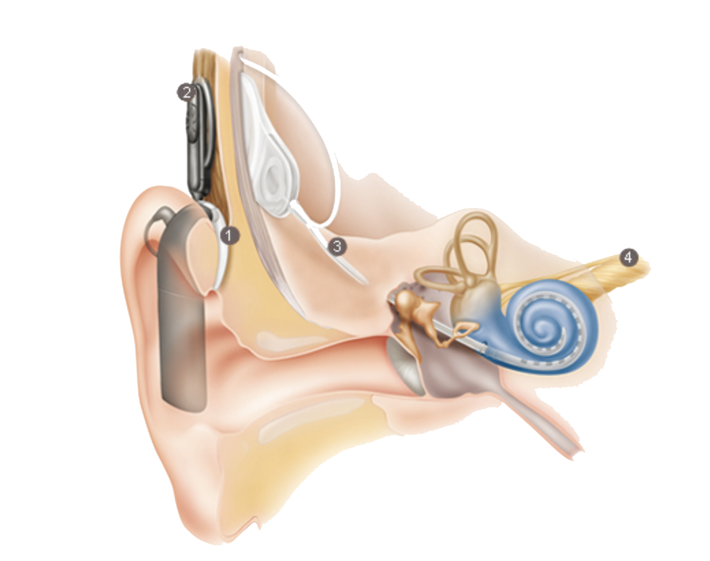 Hearing Aid & Cochlear Implant Services Faith Hearing Specialists