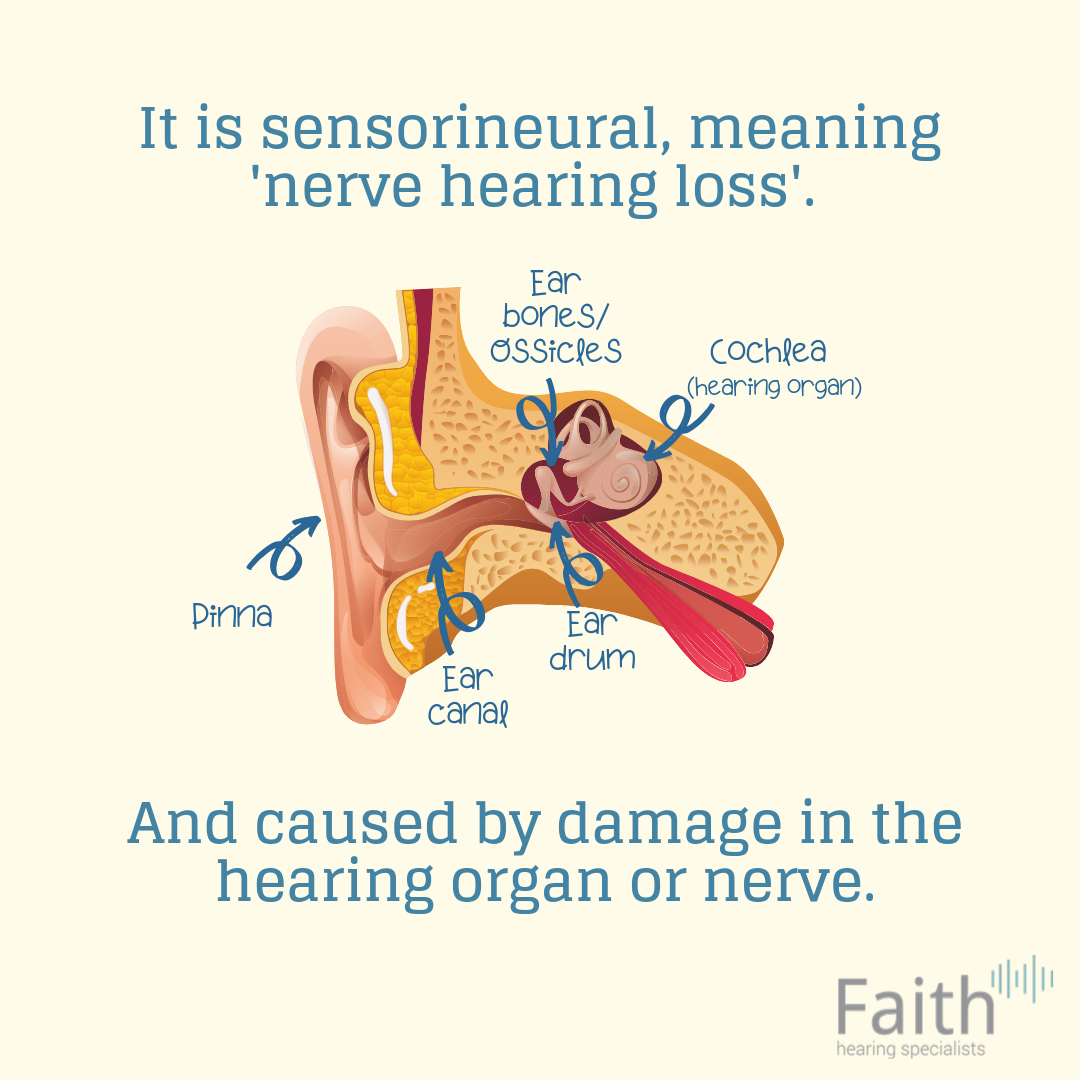 Sudden Sensorineural Hearing Loss