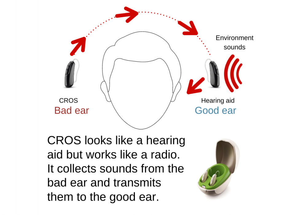 How Cros Hearing Aid works