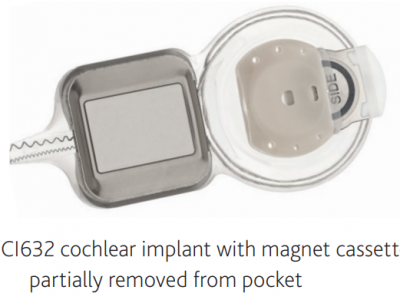 cochlear implant removable magnet