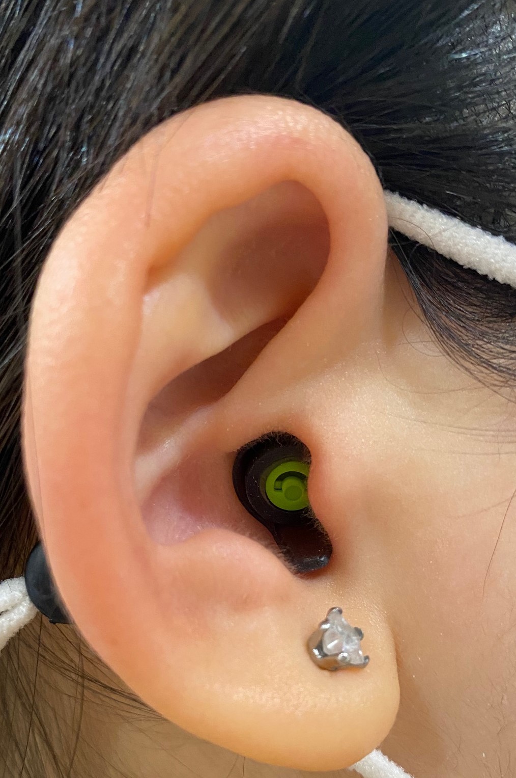 my-ear.jpg