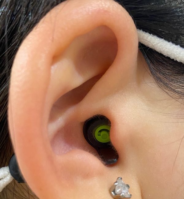my-ear.jpg